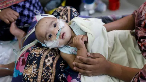 Bangladesh Faces Measles Crisis as Over 100 Children Tragically Lose Their Lives